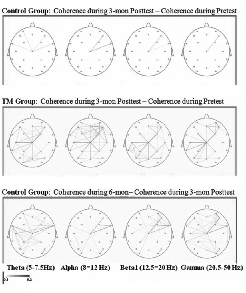 ADHD EEG coherence